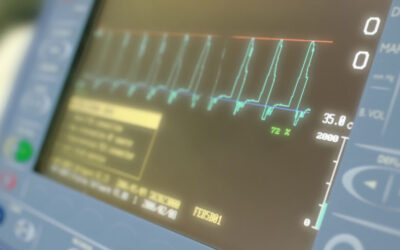 Revolutionizing Cardiac Care: The Role of EECP at Rochester Medical Center